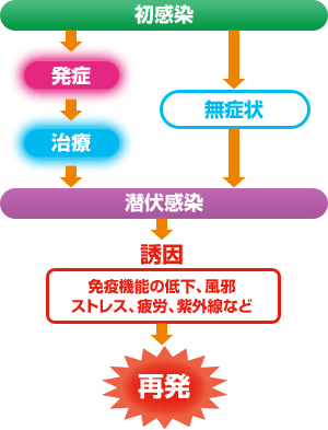 なる ヘルペス 原因 に