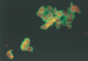 ヘルペスウイルス特異抗原が緑色に染まっている感染細胞