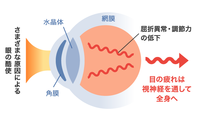 目の疲れが起こるメカニズム