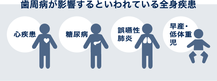 歯周病が影響するといわれている全身疾患