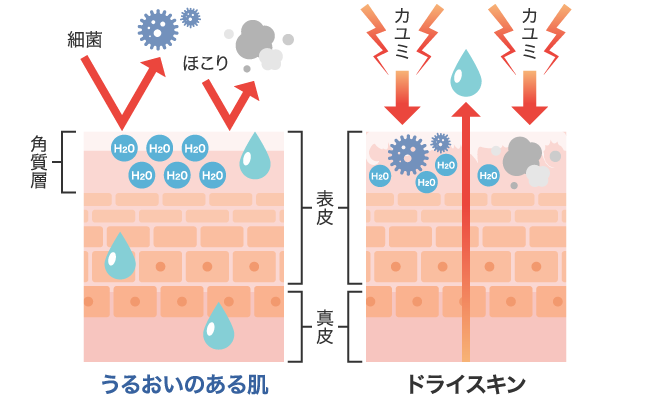 ドライスキンの起こるメカニズム