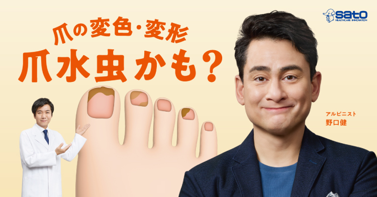 イメージ_爪の変色・変形　爪水虫かも？　アルピニスト 野口健