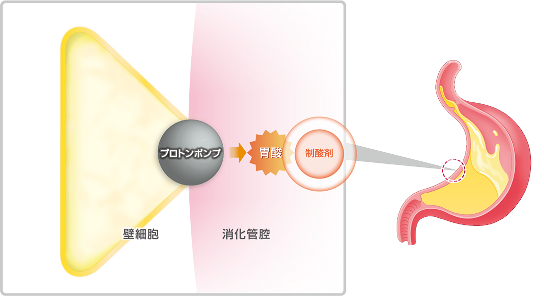胃の中の“酸”を中和イメージ