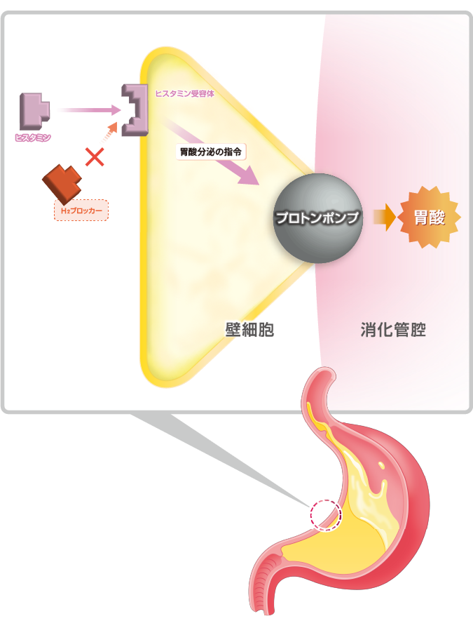胃酸を出す“指令”をブロックして、胃酸の量をおさえるイメージ（スマホ）