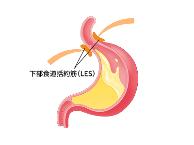 下部食道括約筋（LES）イメージ