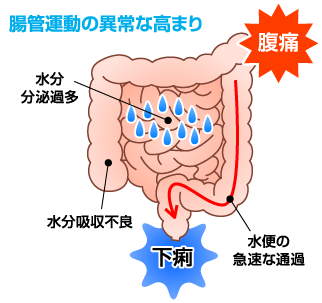 下痢 腹痛 なぜ