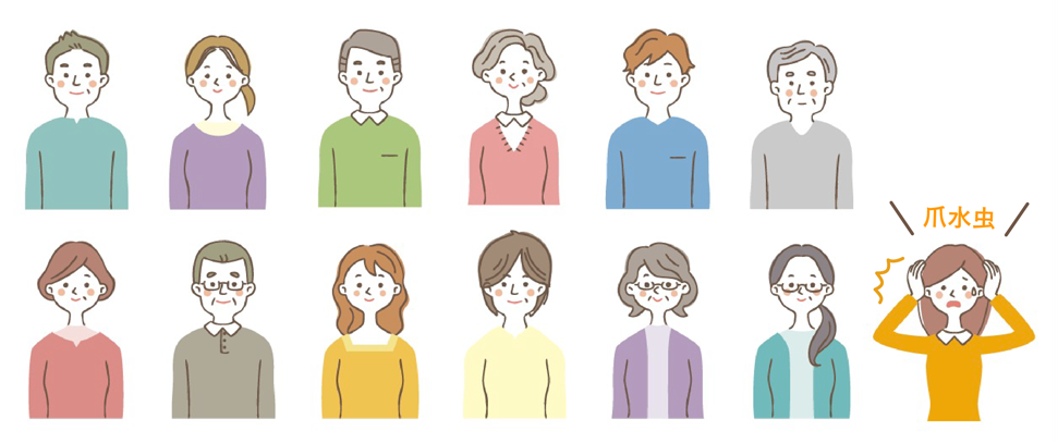 日本人の10人に1人が爪水虫にかかっているとされています イラスト