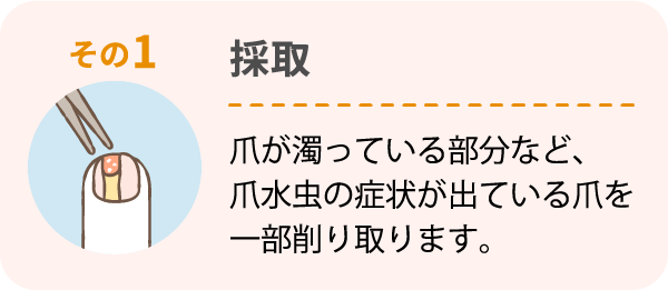 その1 採取 爪が濁っている部分など、爪水虫の症状が出ている爪を一部削り取ります。