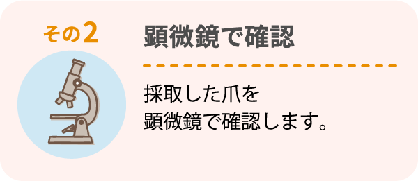 その2 顕微鏡で確認 採取した爪を顕微鏡で確認します。