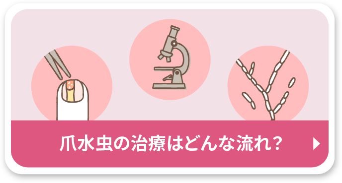 爪水虫の治療はどんな流れ？