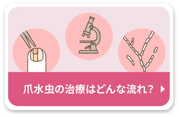 爪水虫の治療はどんな流れ？