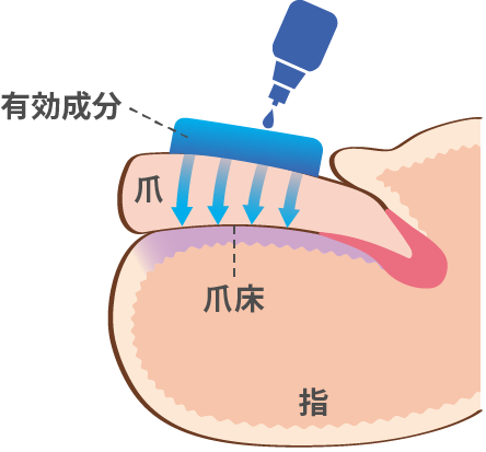 ぬり薬 イラスト